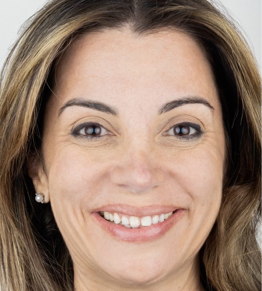 Antes - caso 2 de diseño de sonrisa